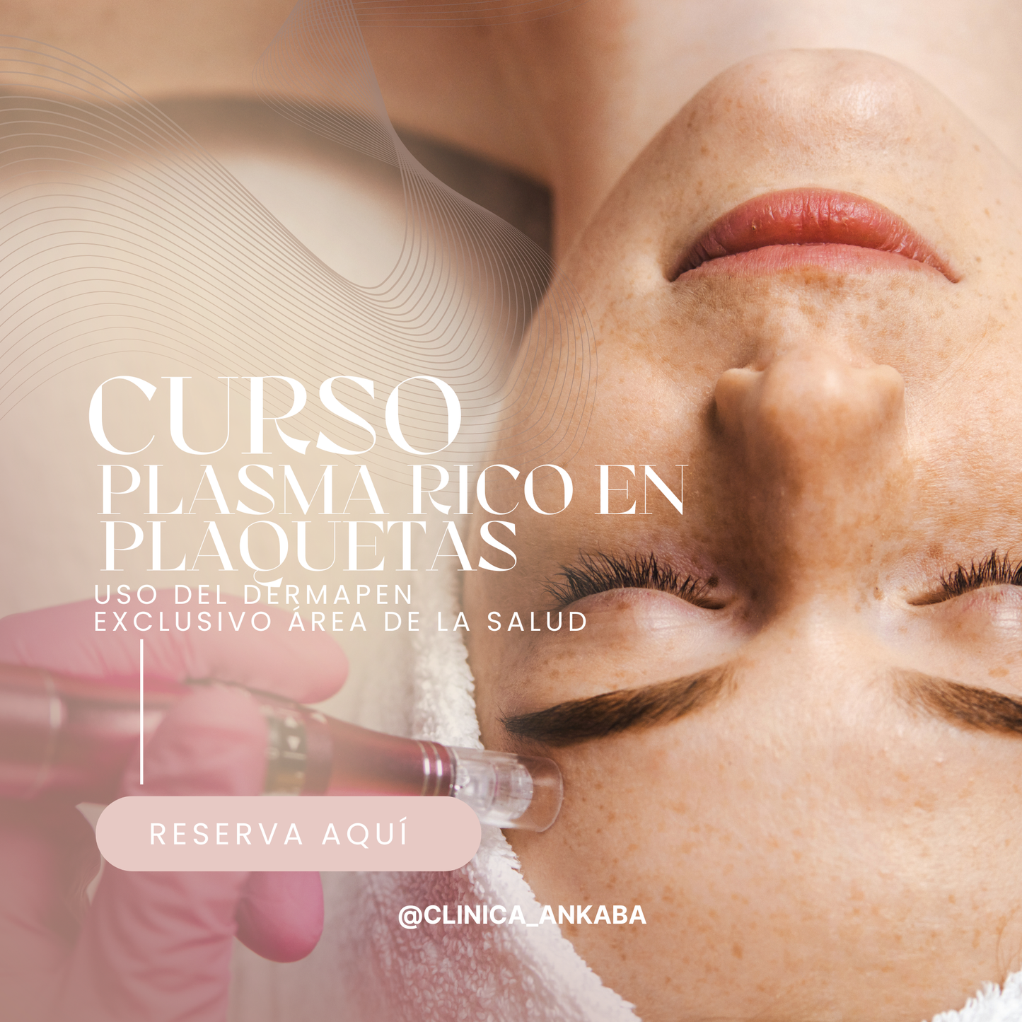 Curso Plasma Rico en Plaquetas