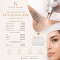 Eliminación de Tatuajes y Cejas con Láser Q-Switch
