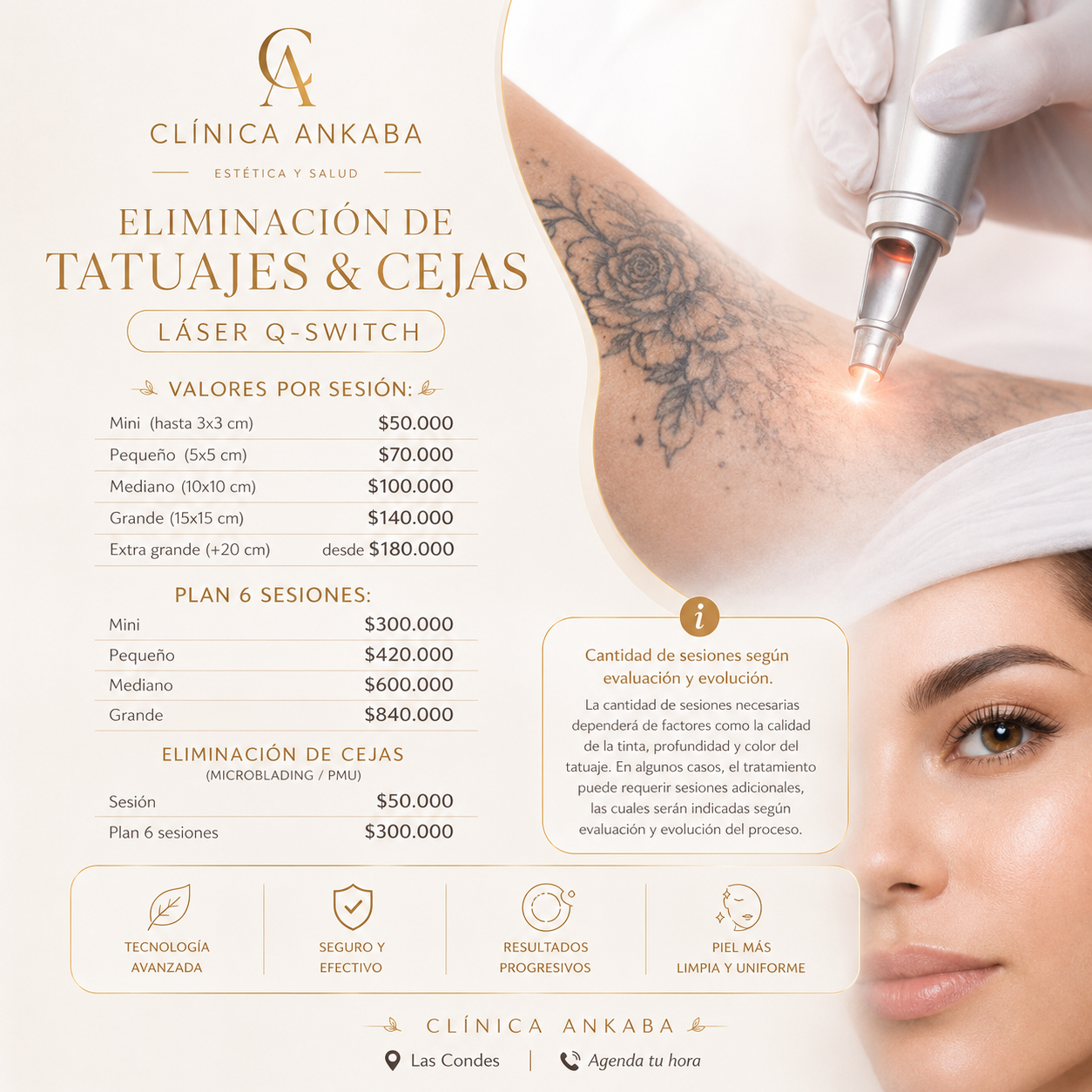 Eliminación de Tatuajes y Cejas con Láser Q-Switch