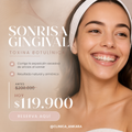 Sonrisa Gingival - Toxina Botulínica