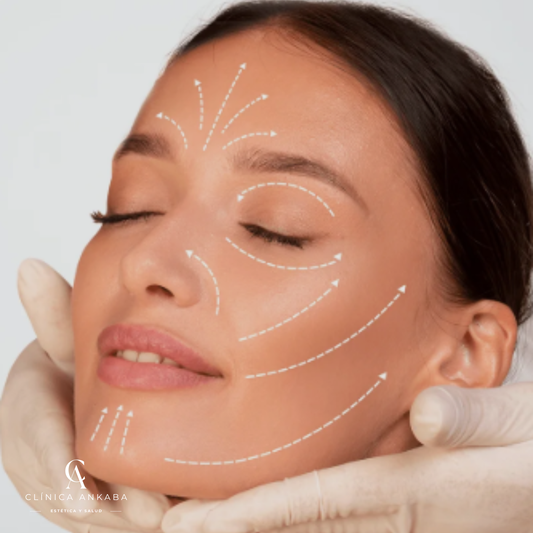 Hilos Tensores en Chile | Lifting Facial Sin Cirugía | Clínica Ankaba Estética & Salud