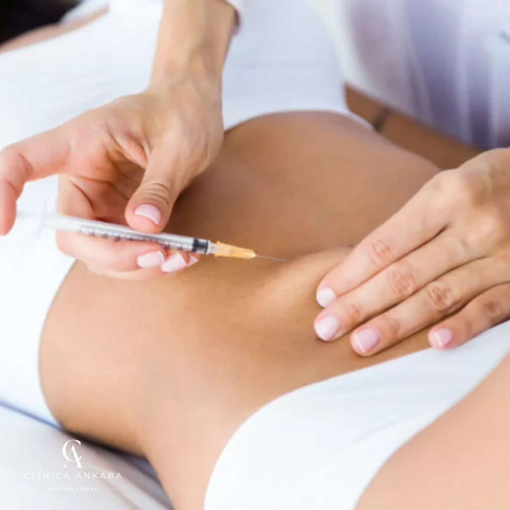 Quemadores de Grasa Localizada en Chile | Reducción de Papada y Zonas Corporales | Clínica Ankaba Estética & Salud