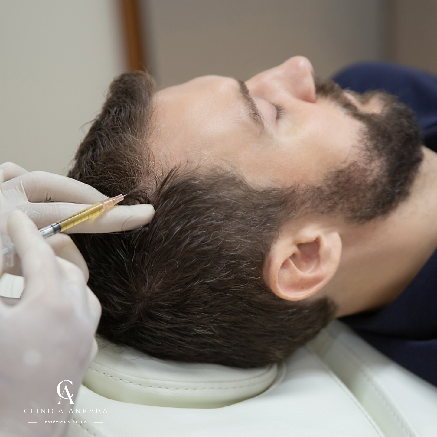 Exosomas en Chile | Regeneración Facial y Capilar | Clínica Ankaba Estética & Salud