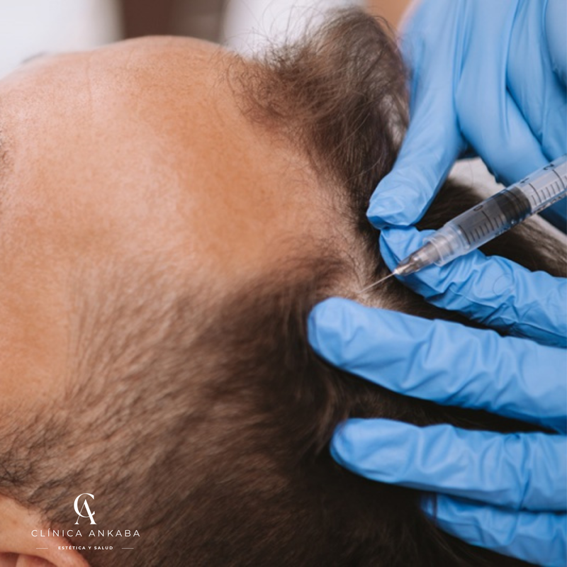 Exosomas en Chile | Regeneración Facial y Capilar | Clínica Ankaba Estética & Salud