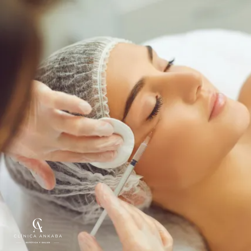 NCTF 135 en Chile | Mesoterapia Facial Bioestimulante | Clínica Ankaba Estética & Salud