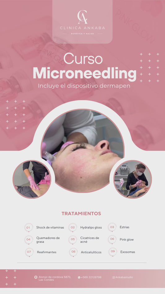Curso  Microneedlind