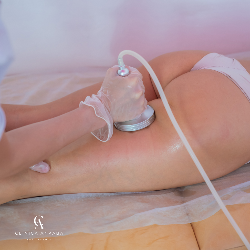 Masajes Reductivos y Descontracturantes en Chile | Clínica Ankaba Estética & Salud
