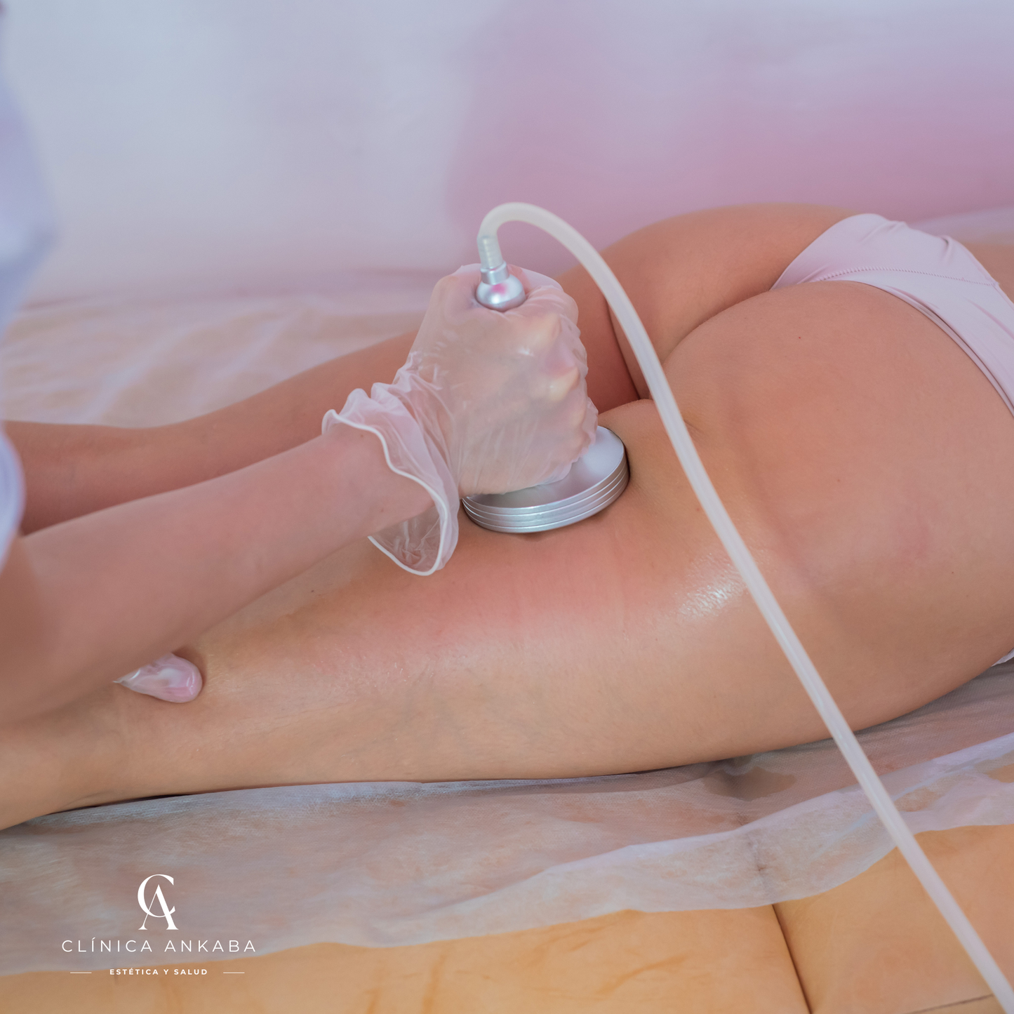 Masajes Reductivos y Descontracturantes en Chile | Clínica Ankaba Estética & Salud