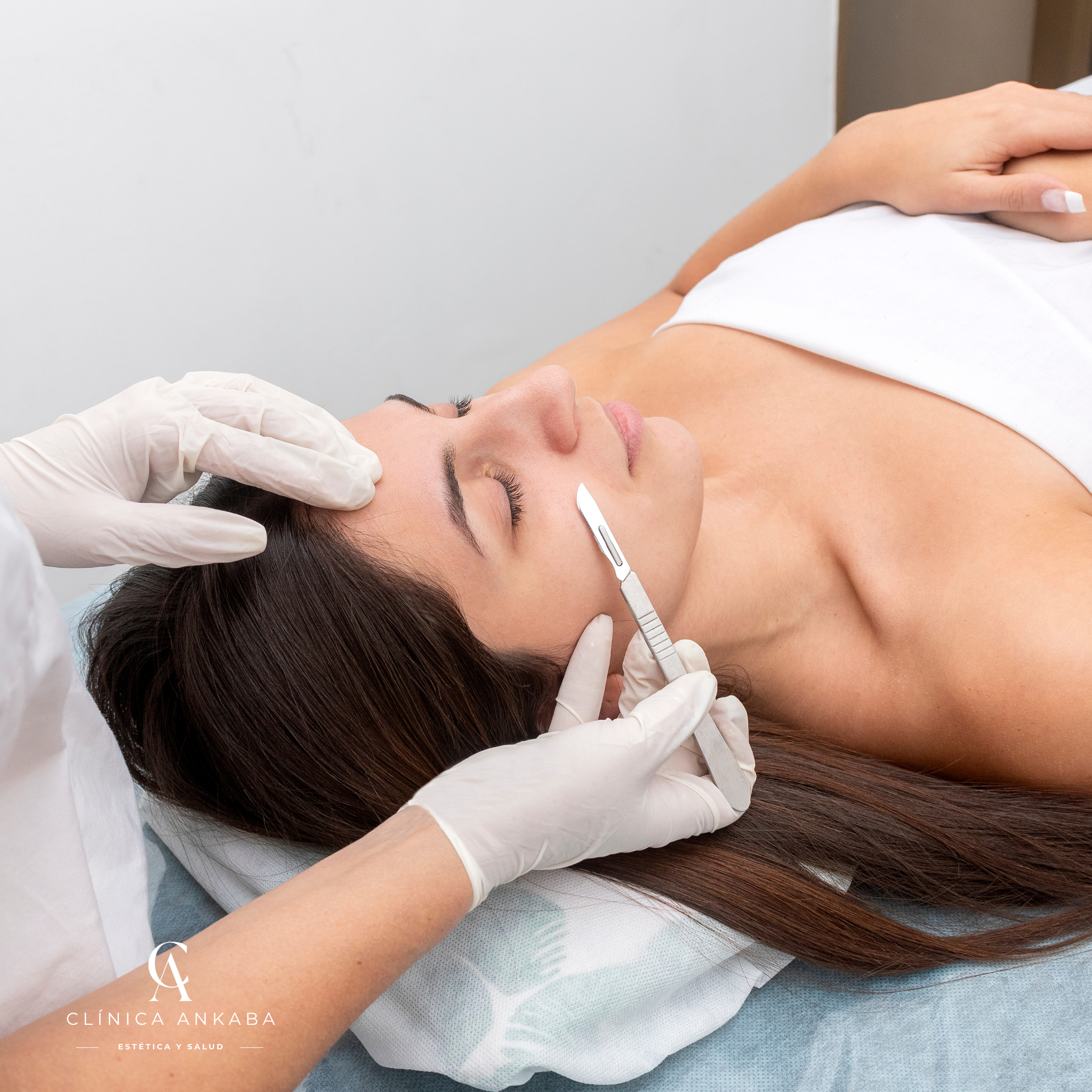 Dermaplaning Facial